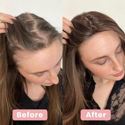 4-in-1 Scalp Massager & Red Light Hair Brush