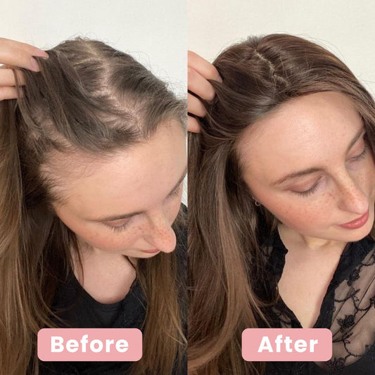 4-in-1 Scalp Massager & Red Light Hair Brush