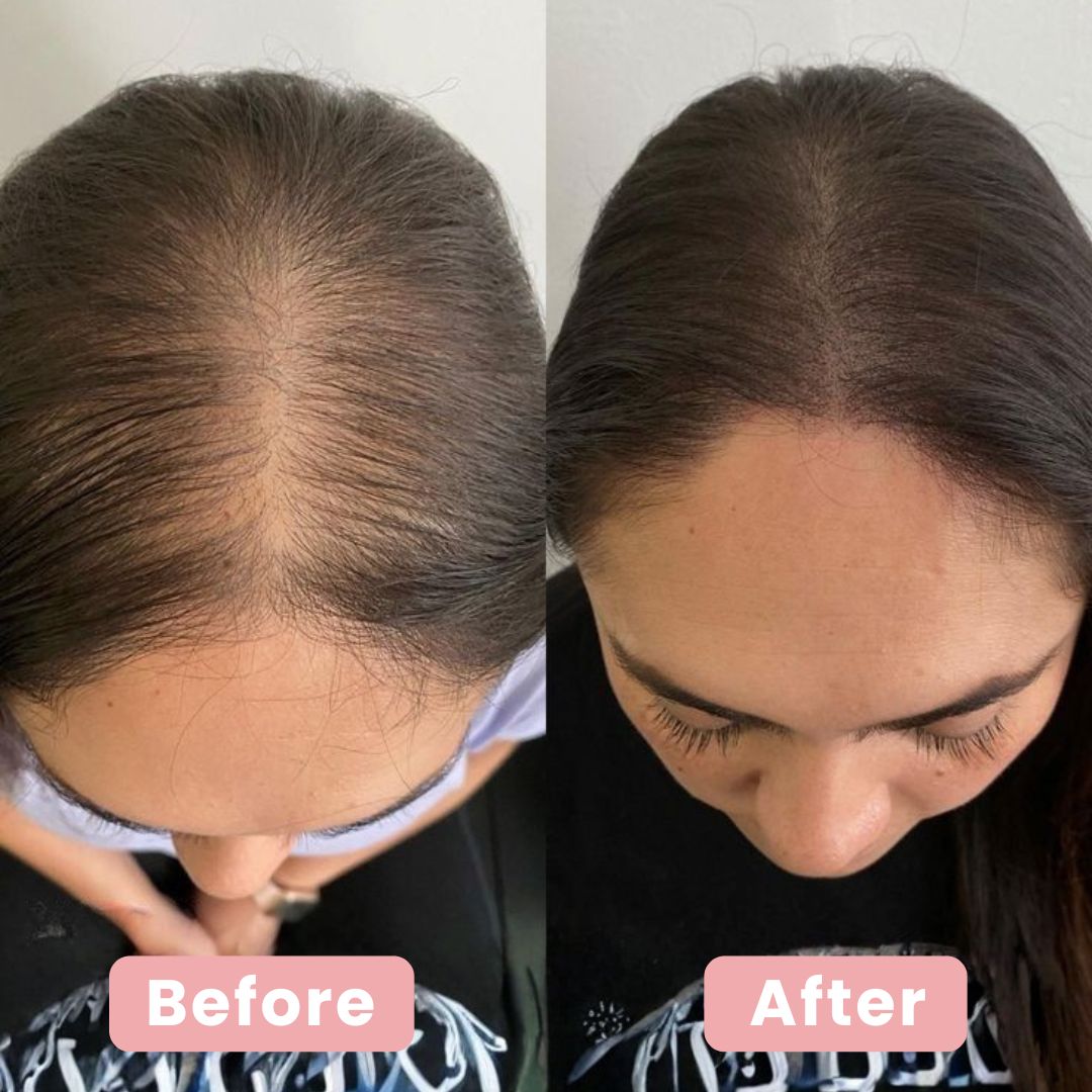 4-in-1 Scalp Massager & Red Light Hair Brush